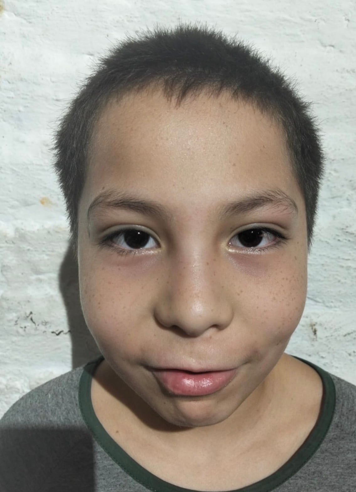 Foto de Gael Anello